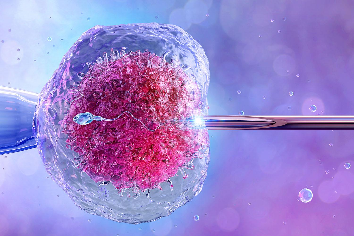 IVF - In Vitro Fertilization