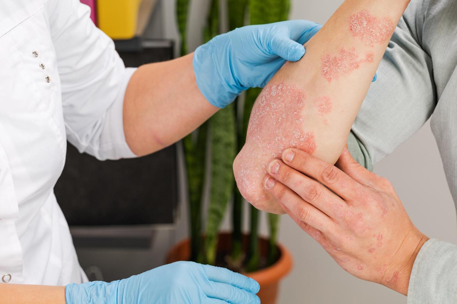 Antifungal